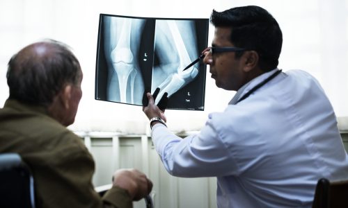 Doctor with a patient's x-ray film